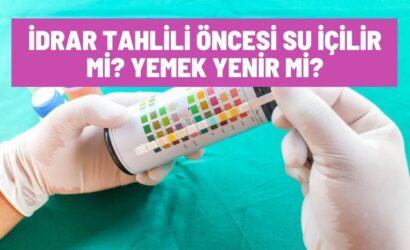 İdrar Tahlili Öncesi Su İçilir Mi?